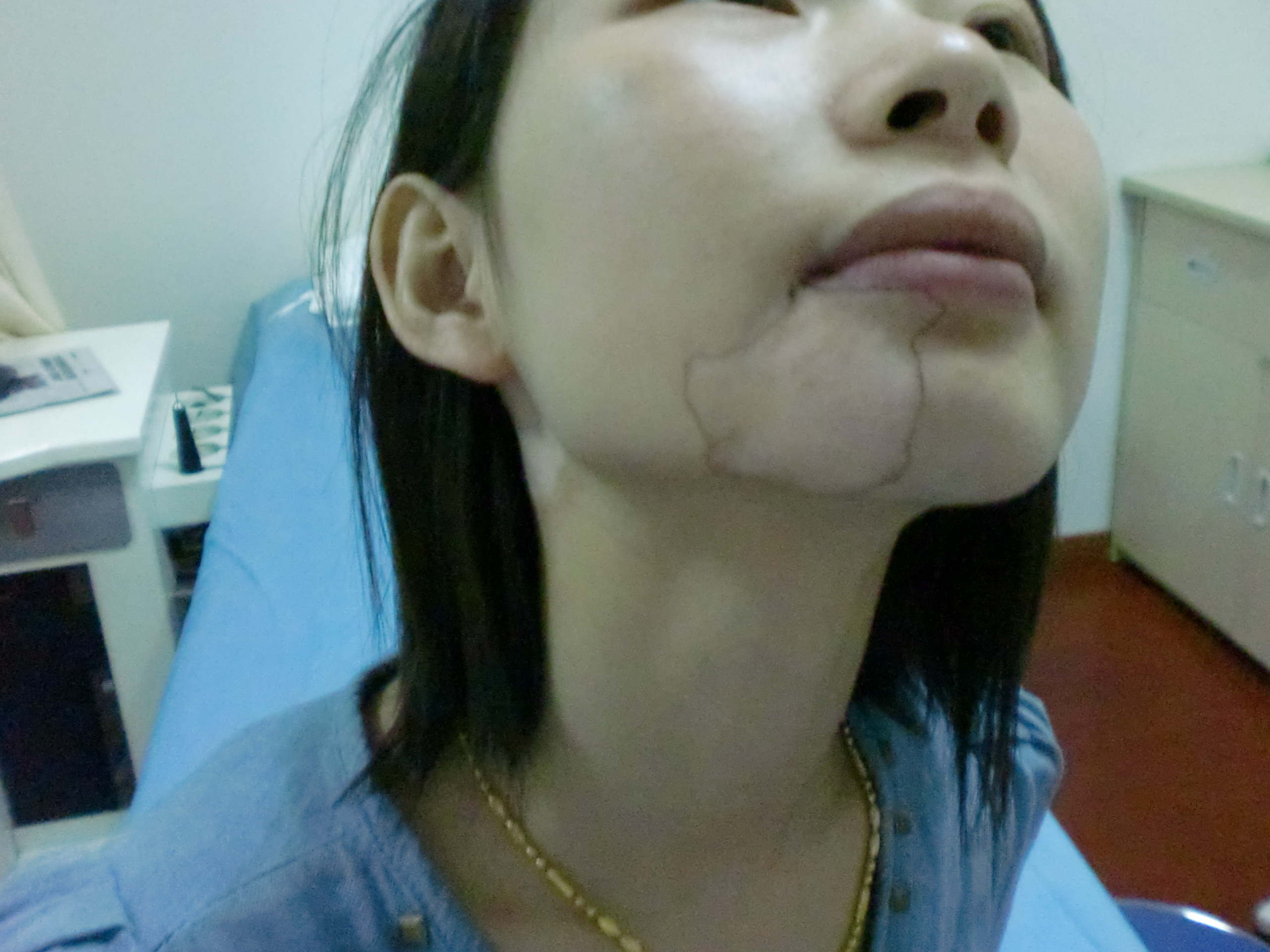 白癜风的辅助治疗JPG